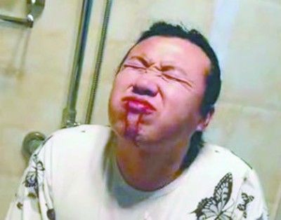 ���B���ӿ��20��׾� ����Ƭ�¾�