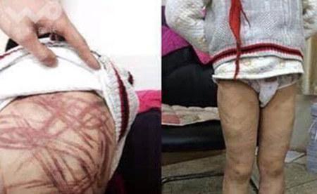 �����P(gu��n)ע�ġ��Ͼ�Űͯ������������11��20������9�r(sh��)���Ͼ�����Ժ�_ͥ�������������F(xi��n)�����(b��o)ӛ�߷քe�ĺ������B(y��ng)ĸ�����ٵĴ����Ɏ�̎�˽⵽��11��13�������������յ����Ͼ�����Ժ�_֪ͥͨ�������ٹ������һ�������Ͼ�����Ժ�������ͥ�����������幫�_������