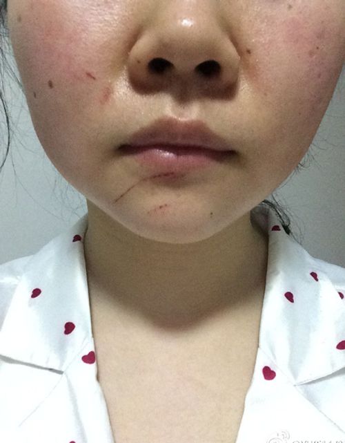 �|���W(w��ng)ӛ�����4��26��?q��ng)?b��o)����������΢���W(w��ng)��@��A�A-2016�Q�����ɽ���һ����Ժͣ܇��(ch��ng)��һİ�������ԷQ������������܇���c(di��n)��͵���ɣ�Ҫ�����ȥ����������ܴ�110��(b��o)��������������늓����u�����������I(l��ng)��δ�������p���m�p���������ܡ�