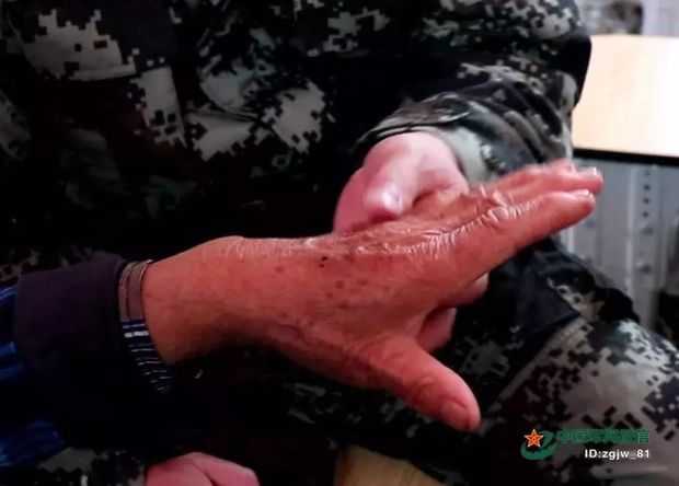 �@�β���30���ҕ�l��׌܊�˸е�ů����